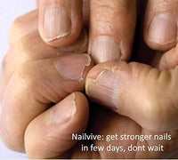 KERATIN RESEARCH NAILVIVE Nail Serum Powerful Magic-like Silk Proteins Proven Natural Formula Strengthening Hardening nails Instantly Prevents Splits Chips Peels Cracks on Your Nails