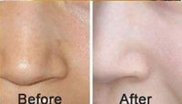 AICHUN BEAUTY Luxurious 24k Gold Bio-collagen Facial Mask (5pcs)