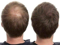 YGH Hair Building Fibers - Conceals Hair Loss in 15 Seconds - 100% Undetectable - 0.98 oz / 28g Bottle - Instantly Thicken Thinning Hair (Auburn)