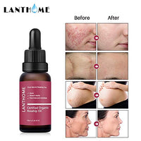 THE ISMA Rosehip Oil for Face, Certified Organic Rosehip Oil, use of Scars, Stretch Marks, Fine lines adn Wrinkes, 10ml