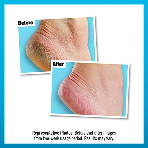 O'Keeffe's Healthy Feet Exfoliating 85g