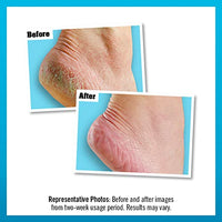 O'Keeffe's Healthy Feet Exfoliating 85g