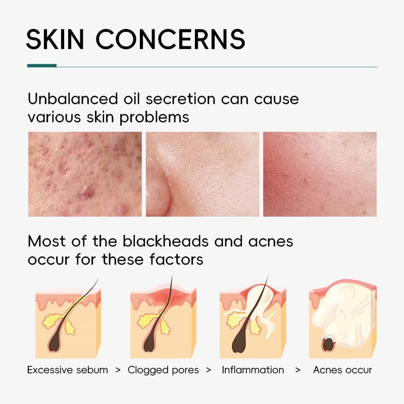 LAIKOU Tea Tree Skincare Set , Anti-Acne Face Care Kit with Cleanser, Toner, Serum, Spot Gel, Cream, Mud Mask & Pimple Patches, Oil Control & Soothing for Teenage Girls, Women & All Skin Types