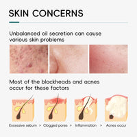 LAIKOU Tea Tree Skincare Set , Anti-Acne Face Care Kit with Cleanser, Toner, Serum, Spot Gel, Cream, Mud Mask & Pimple Patches, Oil Control & Soothing for Teenage Girls, Women & All Skin Types