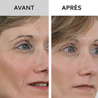 SKINEANCE - WRINKLE FILLER WRINKLE FILLER - Smoothes, fills and smoothes fine lines and wrinkles - Precise, instant and long-lasting results - Proven effectiveness - set of 3 tubes of 15 ml