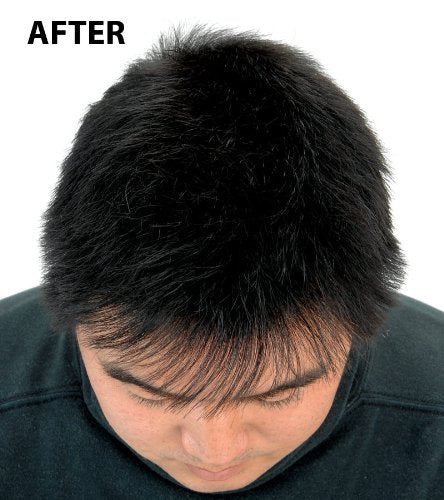 From the UK - Order by 1pm for next working day Super Million Hair - 1 x 40g Hair Building Fibres - No.23 Medium Brown