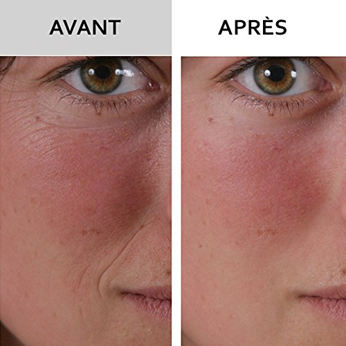 SKINEANCE - WRINKLE FILLER WRINKLE FILLER - Smoothes, fills and smoothes fine lines and wrinkles - Precise, instant and long-lasting results - Proven effectiveness - set of 3 tubes of 15 ml