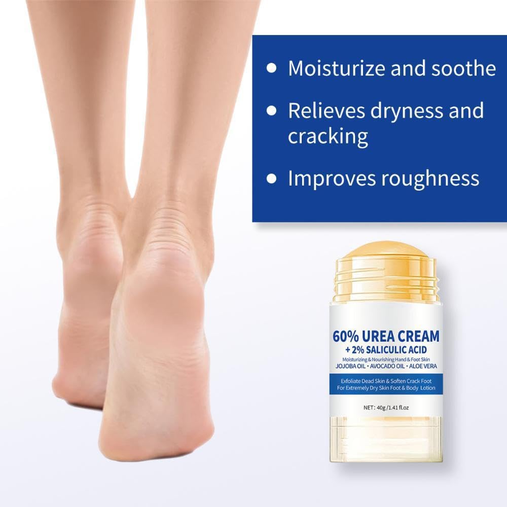 ZoeyShine 60% Urea Foot Cream for Cracked Heels and Dry Skin, Cracked Heel Cream, Skin Care Hands & Feet, Fast Absorbing Non-Greasy Formula with Moisturizing Ingredients