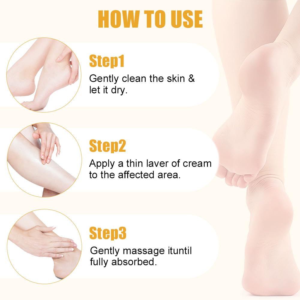 ChicNana Urea Foot Cream, Urea Cream 60 Percent for Feet, Foot Cream for Cracked Heels and Dry Skin, Skin Care Hands & Feet, Cracked Heel Repair Cream, Foot Moisturiser (2pcs)