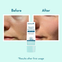 WishCare 5% Niacinamide Oil Balance Fluid Sunscreen SPF 50 PA++++ - Lightweight Matte Sunscreen SPF 50 for Oily Skin & No White Cast 50g