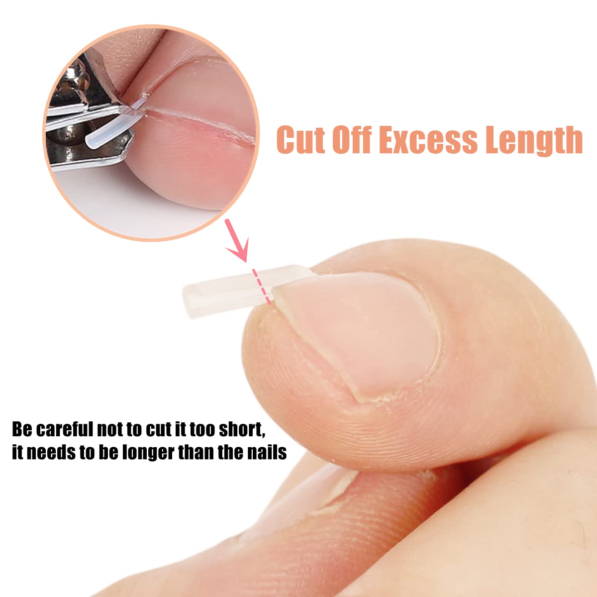 Jinbaetad Ingrown Toenail Correction Treatment Kit with 12 Pcs Ingrown Toenail Correction Pad Recover Clips Ingrown Toenail Corrector Straightener Strips for Women Men's Nail Treatment Pedicure Tool (4 Pcs Set)