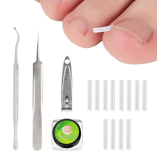 Jinbaetad Ingrown Toenail Correction Treatment Kit with 12 Pcs Ingrown Toenail Correction Pad Recover Clips Ingrown Toenail Corrector Straightener Strips for Women Men's Nail Treatment Pedicure Tool (4 Pcs Set)