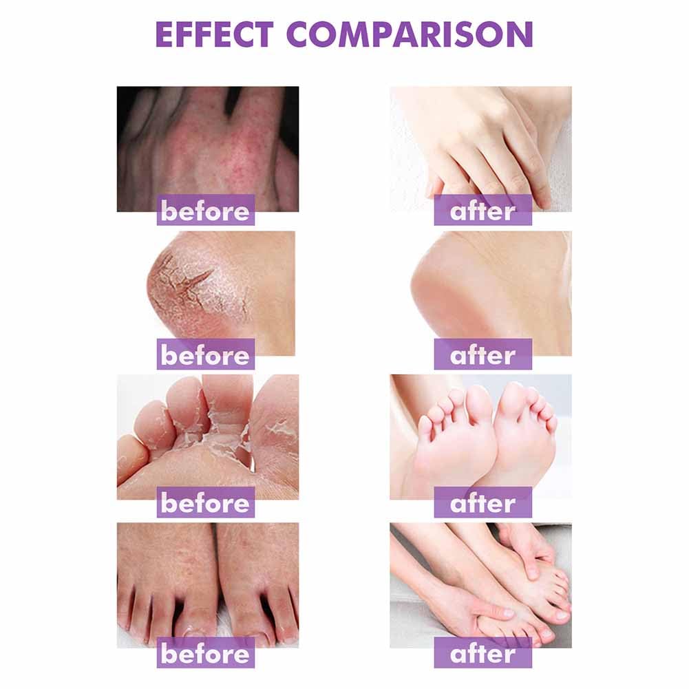 Allbestaye Mother of Skin Creams Body Cream - Eczema Cream & Body Moisturiser for Dry Sensitive Skin, Long-Lasting Hydration for Hands, Feet & Body, Natural Ingredients, 100g