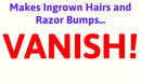 V Series Creams V22 MAX Ingrown Hair Treatment Cream Double Strength Paraben and Cruelty Free - 50ml