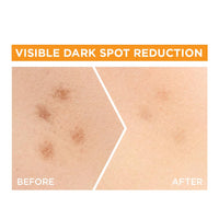 Garnier SkinActive Fast Bright Booster Serum - 30 ml