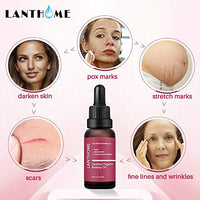 THE ISMA Rosehip Oil for Face, Certified Organic Rosehip Oil, use of Scars, Stretch Marks, Fine lines adn Wrinkes, 10ml