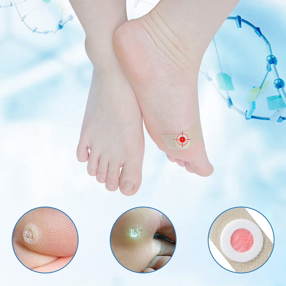 Cherioll Wart Remover, Wart Remover Pads, Wart Treatment, Wart Remover for Hands, Feet, Feet Callus Remove, Verruca and Wart, Relief Pain Removal Warts Plaster, Soften Skin Cutting Sticker Toe Protector, 20 PC