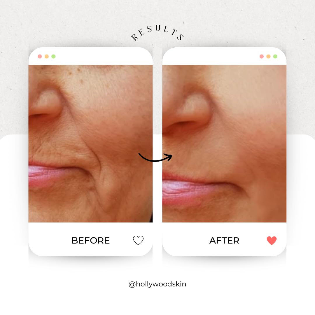 Dark Spot Corrector Remover for Face - Skin lightening & whitening cream. 4x STONGER than regular hyperpigmenation treatments. Reduces & fades dark spots. 50ml