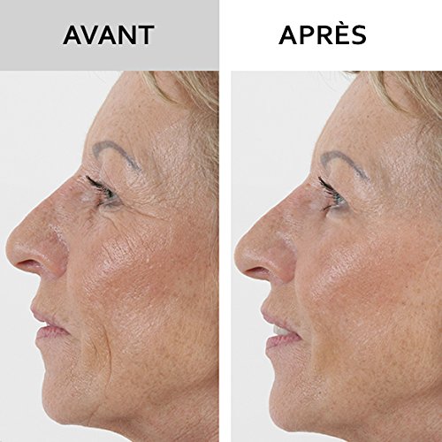 SKINEANCE - WRINKLE FILLER WRINKLE FILLER - Smoothes, fills and smoothes fine lines and wrinkles - Precise, instant and long-lasting results - Proven effectiveness - set of 3 tubes of 15 ml