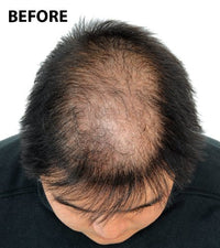 From the UK - Order by 1pm for next working day Super Million Hair - 1 x 40g Hair Building Fibres - No.23 Medium Brown