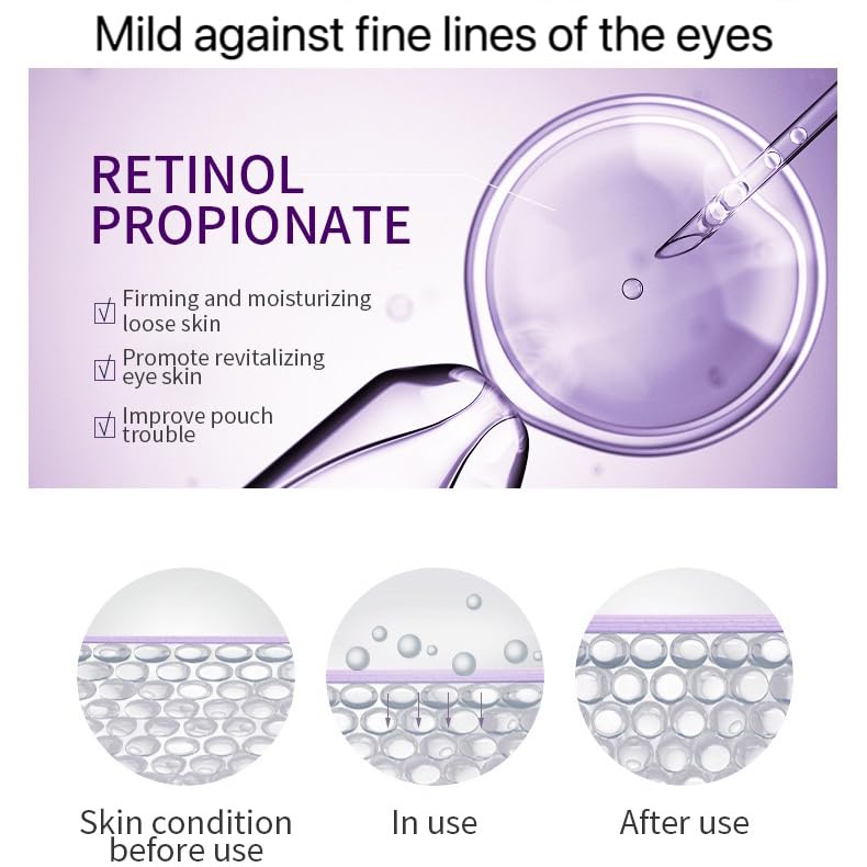Retinol Eye Cream-Eye Cream For Dark Circles And Puffy Eyes,Anti-Aging Eye Cream With Retinol Serum,Hyaluronic Acid,Retinol Serum-Anti Wrinkle Eye Cream-Moisturising Eye Bags Remover