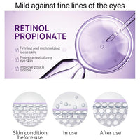 Retinol Eye Cream-Eye Cream For Dark Circles And Puffy Eyes,Anti-Aging Eye Cream With Retinol Serum,Hyaluronic Acid,Retinol Serum-Anti Wrinkle Eye Cream-Moisturising Eye Bags Remover
