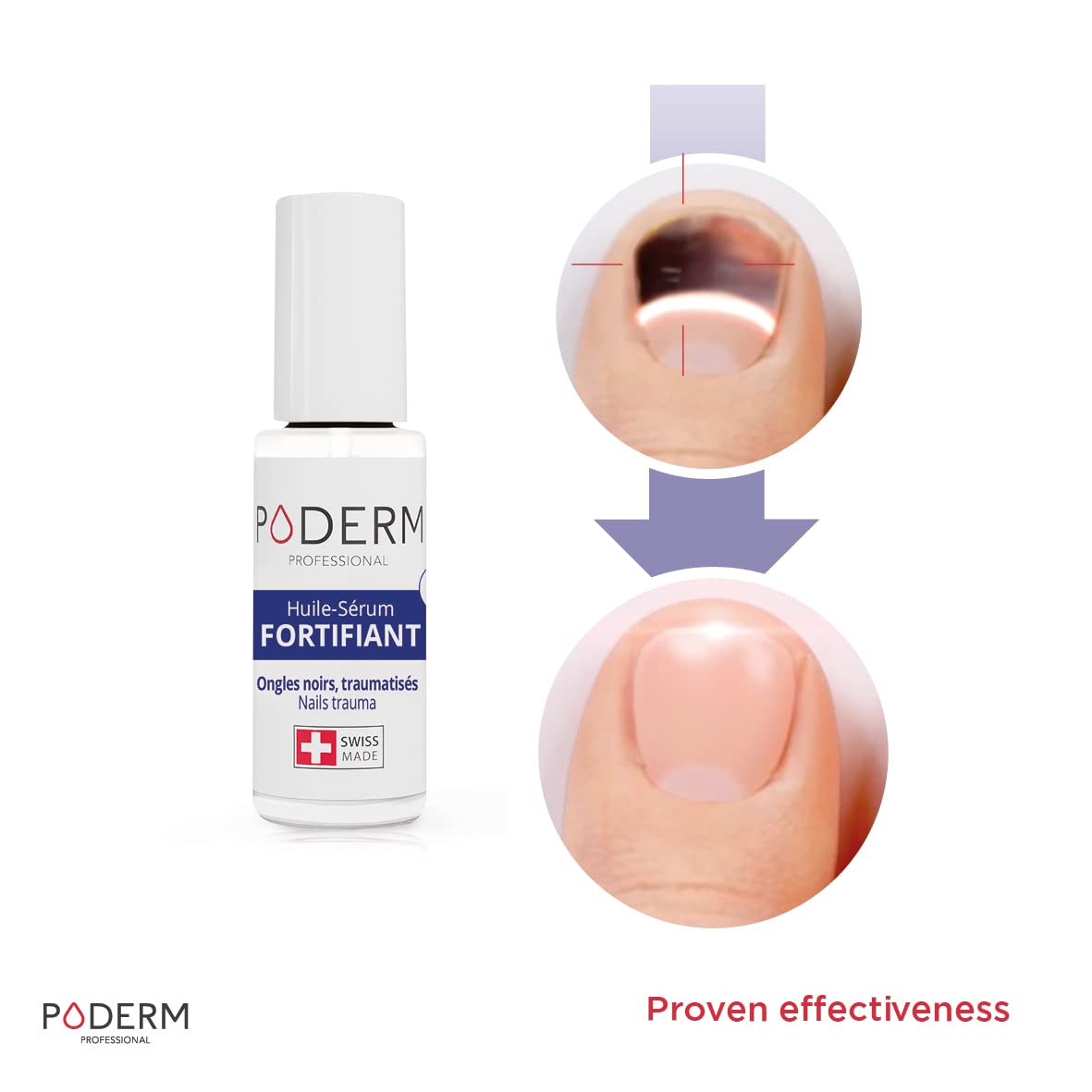 PODERM - BLACK AND INJURED NAILS 2-in-1 TREATMENT - BIO & VEGAN - Suitable for active people (football, hiking ...) - Professional foot/hand treatment - Quick & easy - Swiss Made