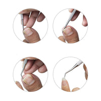 Yosoo Health Gear Long Handled Toenail Scissors, Extra Long Stainless Steel Nail Clippers with Nail File, Easy Reach Cutter for Thick Ingrown Nails for Elderly and Pregnant Women