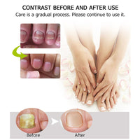 Nail Repair - Nail Treatment Repair Gel/Nail & Toenail Treatment Nail Repair Cream/Toe Be Health Instant Beauty Cream, Renews Yellow, Cracked, Damaged and Split Nails