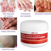 Allbestaye Mother of Skin Creams Body Cream - Eczema Cream & Body Moisturiser for Dry Sensitive Skin, Long-Lasting Hydration for Hands, Feet & Body, Natural Ingredients, 100g