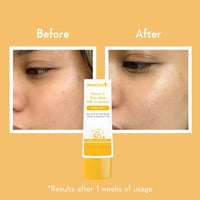 WishCare Vitamin C Pure Glow Milk Sunscreen SPF 50 PA++++ for Glowing Skin - Broad Spectrum Light Weight Sunscreen SPF 50 for Dry Skin & Oily Skin 50g