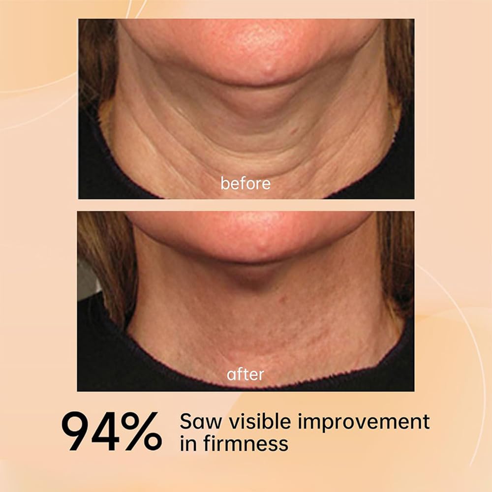 KlsyChry AH-8 Firming Neck Cream, Neck Firming Cream with Roller, Reduce Wrinkles Fine Lines And Double Chin, Firm and Lift Sagging Skin, 120g