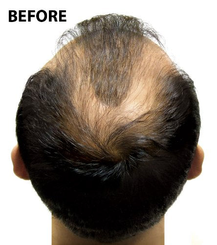 Super Million Hair - 1 x 40g Hair Building Fibres - No.6 Light Blonde by From the UK - Order by 1pm for next working day