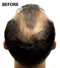 Super Million Hair - 1 x 40g Hair Building Fibres - No.6 Light Blonde by From the UK - Order by 1pm for next working day