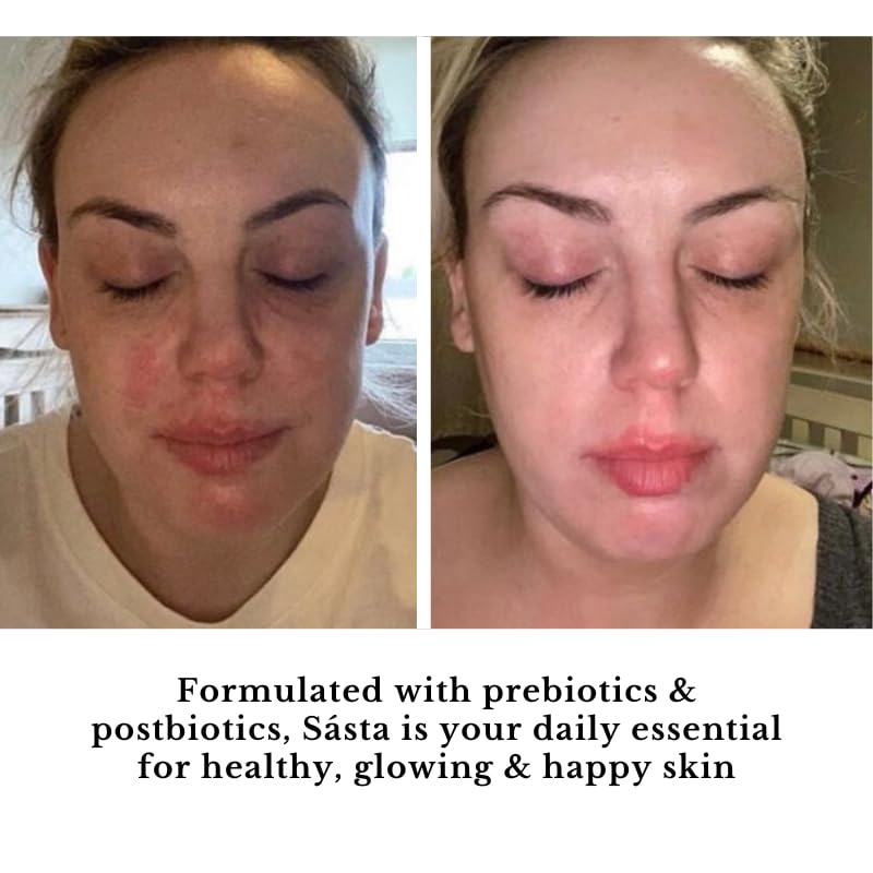 Sásta Skin Health Sásta Microbiome Booster Serum – Prebiotic & Postbiotic Face Serum for Skin Barrier Repair, Hydration, & Anti-Redness, Suitable for All Skin Types 30ml