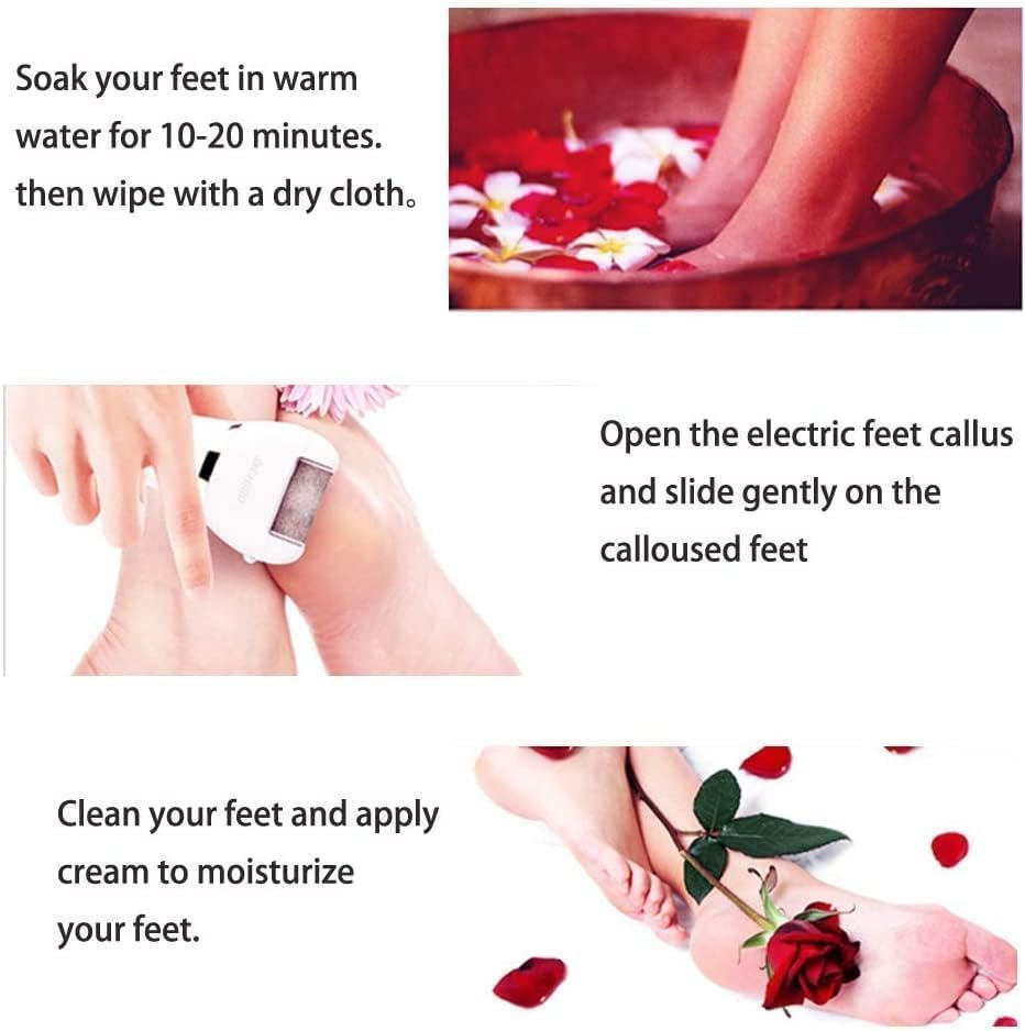 Swhily Foot Callus Remover, Professional Electric Pedicure Callus Remover, Rechargeable Foot File with 6 Roller Heads for Feet Care
