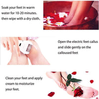 Swhily Foot Callus Remover, Professional Electric Pedicure Callus Remover, Rechargeable Foot File with 6 Roller Heads for Feet Care