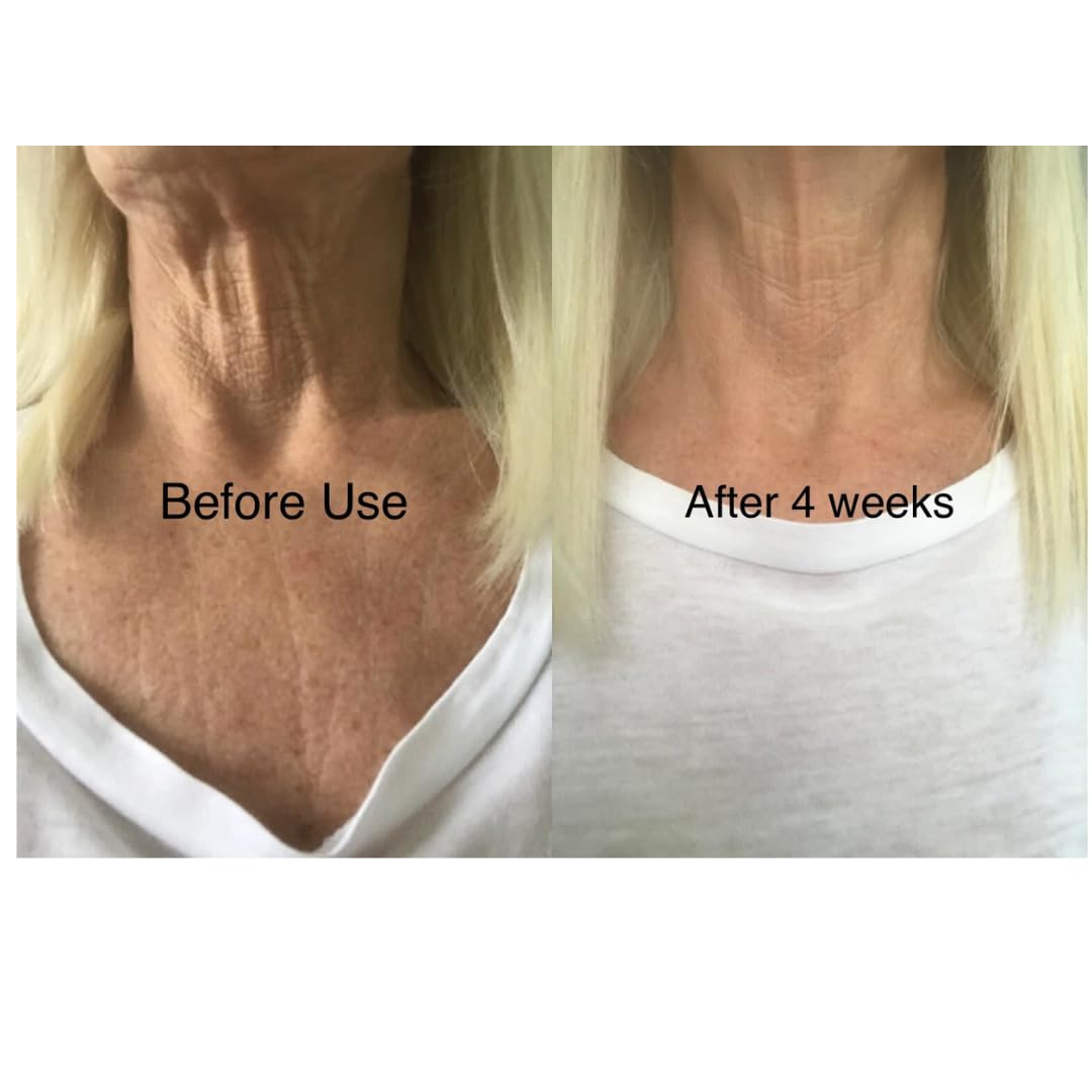 Skinremide 2 Silicon Neck Wrinkle Pads - Anti Wrinkle Premium Reusable Patches for Skin Lines Prevention - Wrinkle Smoothing Overnight Treatment for Neck