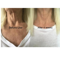 Skinremide 2 Silicon Neck Wrinkle Pads - Anti Wrinkle Premium Reusable Patches for Skin Lines Prevention - Wrinkle Smoothing Overnight Treatment for Neck