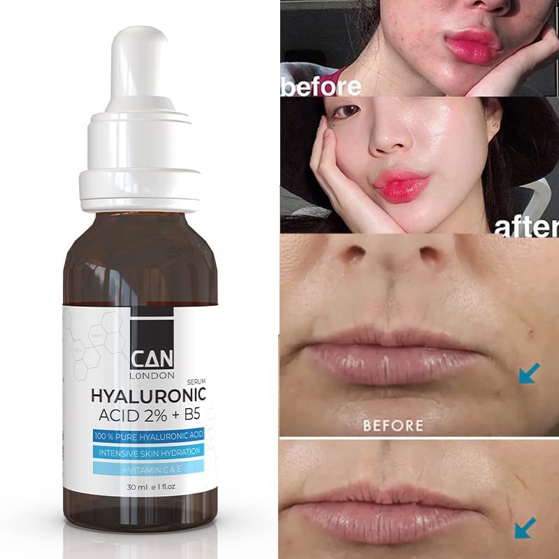 ICAN LONDON ican london Pure Hyaluronic Acid + B5 serum for face Dark sport correction, Anti-aging, fine line & wrinkles With vitamin C & E 30ml