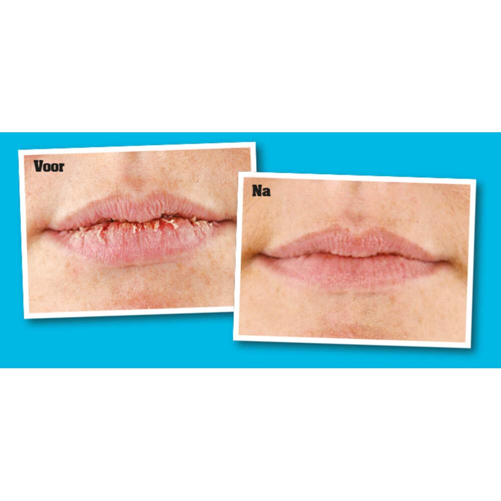 O'Keeffe's Lip Repair - Ongeparfumeerd (ongeparfumeerd)
