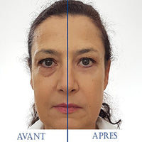 SKINEANCE - Magic Serum - Eye contour tensing effect - Smoothes fine lines and wrinkles - Reduces puffiness under the eyes - Acts in less than 3 minutes - Effective 8 to 10 hours - 5 tubes of 2 ml...