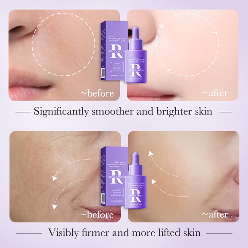 YUYUE-YY Retinol Serum, Anti Aging Retinol Serum for Face & Neck, Cream Serum for Smoothing Fine Lines and Skin Brightening, Anti Wrinkle Serum for Skin Repair, Acne, Scar, Dark Spot, Fine Line and Wrinkles