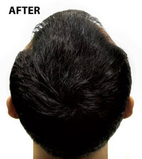 Super Million Hair - 1 x 40g Hair Building Fibres - No.6 Light Blonde by From the UK - Order by 1pm for next working day
