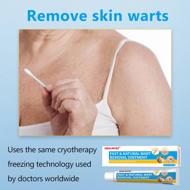 Shileoo Wart Remover 20g, Effective Verruca Freeze Wart Treatment, Plantar Warts, Common Warts, Flat Warts, Corns, Calluses