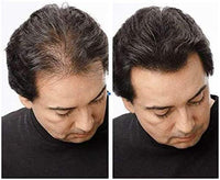 YGH Hair Building Fibers - Conceals Hair Loss in 15 Seconds - 100% Undetectable - 0.98 oz / 28g Bottle - Instantly Thicken Thinning Hair