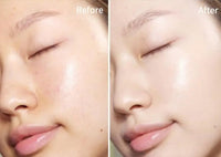 Epiphany Vibe EGF Serum for Microneedling, Micro Infusion, Mesotherapy Ampoule Serum Hyaluronic Acid Peptides Skin Repairing