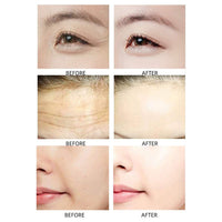 SEGMINISMART Nail Anti Wrinkle Patches 15ml