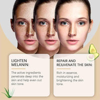 Heyzeibo LEFUN Melanin Correcting Cream, Lefun Melanin, Dark Spot Corrector Cream, Dark Spot Remover For Body, Underarm, Elbows, Knees, Neck, Armpit (2pcs)