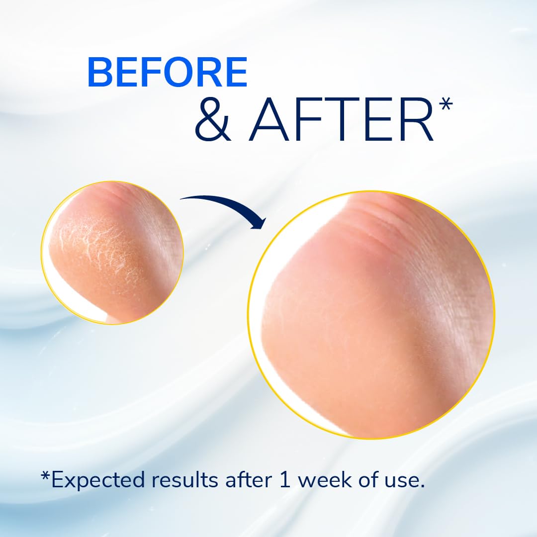 Dr. Scholl's Scholl Severe Cracked Heel Repair Restoring Balm, to repair Very Dry and Cracked Heels, Intensely Moisturising for Healthy Feet with 25% Urea, Epsom Salts and Essential Oils